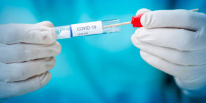 PCR test covid